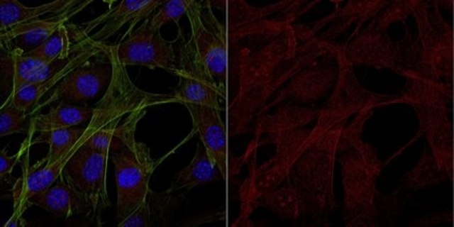 Anti-Interleukin-1&#946; Antibody, Alexa Fluor&#8482; 555 Conjugate from rabbit, ALEXA FLUOR&#8482; 555
