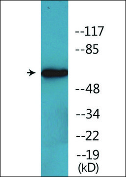 Anti-phospho-RIPK2 (pSer176) antibody produced in rabbit affinity isolated antibody