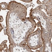 Anti-CEP162 antibody produced in rabbit Prestige Antibodies&#174; Powered by Atlas Antibodies, affinity isolated antibody, buffered aqueous glycerol solution, ab1