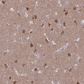 Anti-FBXL16 antibody produced in rabbit Prestige Antibodies&#174; Powered by Atlas Antibodies, affinity isolated antibody, buffered aqueous glycerol solution