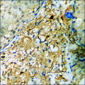 Anti-phospho-Akt (pSer473) antibody produced in rabbit affinity isolated antibody