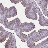 Anti-ANXA5 antibody produced in rabbit Prestige Antibodies&#174; Powered by Atlas Antibodies, affinity isolated antibody, buffered aqueous glycerol solution