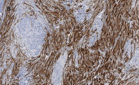 Anti-Calponin 1 Antibody, clone 9D14, ZooMAb&#174; Rabbit Monoclonal recombinant, expressed in HEK 293 cells