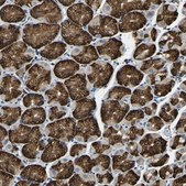 Anti-RNF115 antibody produced in rabbit Prestige Antibodies&#174; Powered by Atlas Antibodies, affinity isolated antibody, buffered aqueous glycerol solution