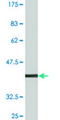Monoclonal Anti-ARHGEF6 antibody produced in mouse clone 2E5, purified immunoglobulin, buffered aqueous solution