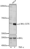 Anti-Phospho-IKK&#947;-S376 antibody produced in rabbit