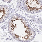 Anti-HSPA4L antibody produced in rabbit Prestige Antibodies&#174; Powered by Atlas Antibodies, affinity isolated antibody, buffered aqueous glycerol solution