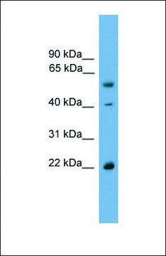 Anti-WBP4, (N-terminal) antibody produced in rabbit affinity isolated antibody