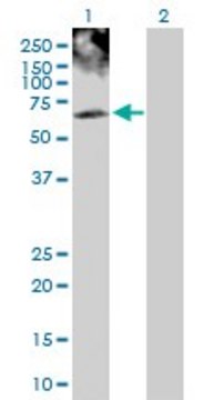 Anti-PHKG2 antibody produced in rabbit purified immunoglobulin, buffered aqueous solution