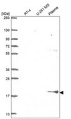 Anti-Bst2 Antibody Produced In Rabbit Prestige Antibodies&#174; Powered by Atlas Antibodies, affinity isolated antibody, buffered aqueous glycerol solution