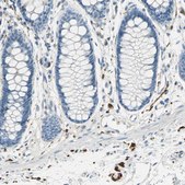 Anti-UCHL1 antibody produced in rabbit Prestige Antibodies&#174; Powered by Atlas Antibodies, affinity isolated antibody, buffered aqueous glycerol solution