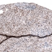 Monoclonal Anti-Smarcb1 Antibody Produced In Mouse Prestige Antibodies&#174; Powered by Atlas Antibodies, clone CL13973, affinity isolated antibody, buffered aqueous glycerol solution