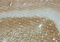 Anti-Tau-1 Antibody, clone PC1C6 clone PC1C6, Chemicon&#174;, from mouse