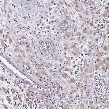 Anti-ZFP1 antibody produced in rabbit Prestige Antibodies&#174; Powered by Atlas Antibodies, affinity isolated antibody, buffered aqueous glycerol solution