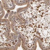 Anti-VSIG4 antibody produced in rabbit affinity isolated antibody, buffered aqueous glycerol solution
