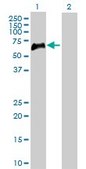 Anti-TNFRSF1B antibody produced in rabbit purified immunoglobulin, buffered aqueous solution