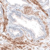 Monoclonal Anti-ITGB3 antibody produced in mouse Prestige Antibodies&#174; Powered by Atlas Antibodies, clone CL7319, purified immunoglobulin, buffered aqueous glycerol solution