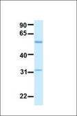 Anti-ACVR1 antibody produced in rabbit affinity isolated antibody