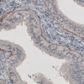 Monoclonal Anti-LAMC1 antibody produced in mouse Prestige Antibodies&#174; Powered by Atlas Antibodies, clone CL3195, purified immunoglobulin, buffered aqueous glycerol solution