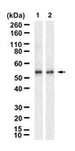 Anti-&#948; Tubulin Antibody, clone 1B20 ZooMAb&#174; Rabbit Monoclonal recombinant, expressed in HEK 293 cells