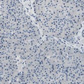 Anti-NFASC antibody produced in rabbit Prestige Antibodies&#174; Powered by Atlas Antibodies, affinity isolated antibody, buffered aqueous glycerol solution