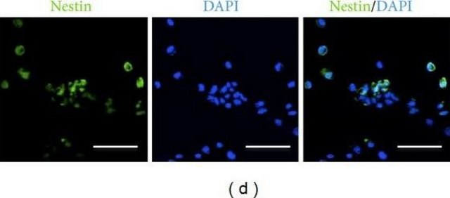 Anti-Nestin Antibody, clone 10C2 clone 10C2, Chemicon&#174;, from mouse