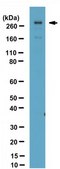 Anti-Stabilin-1 Antibody, CT from rabbit