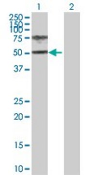 Anti-HGD antibody produced in rabbit purified immunoglobulin, buffered aqueous solution