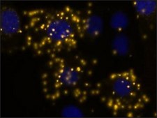 Duolink&#174; In Situ Detection Reagents Orange