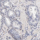 Anti-LAMB1 antibody produced in rabbit Ab2, Prestige Antibodies&#174; Powered by Atlas Antibodies, affinity isolated antibody, buffered aqueous glycerol solution