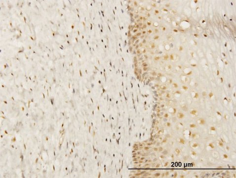 Monoclonal Anti-FKBP4 antibody produced in mouse clone 5C11, purified immunoglobulin, buffered aqueous solution