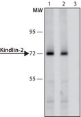 Anti-Kindlin-2 antibody produced in rabbit ~1.0&#160;mg/mL, affinity isolated antibody, buffered aqueous solution