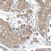 Anti-GADD45G antibody produced in rabbit Prestige Antibodies&#174; Powered by Atlas Antibodies, affinity isolated antibody, buffered aqueous glycerol solution