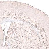 Monoclonal Anti-FOXP2 antibody produced in mouse Prestige Antibodies&#174; Powered by Atlas Antibodies, clone CL5312, purified immunoglobulin, buffered aqueous glycerol solution