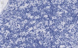Anti-CD8&#946; Antibody, clone 1H21 ZooMAb&#174; Rabbit Monoclonal recombinant, expressed in HEK 293 cells