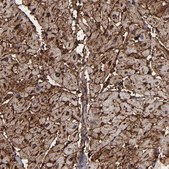 Anti-CD36 antibody produced in rabbit Prestige Antibodies&#174; Powered by Atlas Antibodies, affinity isolated antibody, buffered aqueous glycerol solution