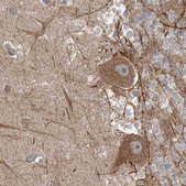 Anti-LRPPRC antibody produced in rabbit Prestige Antibodies&#174; Powered by Atlas Antibodies, affinity isolated antibody, buffered aqueous glycerol solution