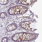 Anti-LRRC26 antibody produced in rabbit Prestige Antibodies&#174; Powered by Atlas Antibodies, affinity isolated antibody, buffered aqueous glycerol solution