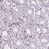 Anti-CD40LG antibody produced in rabbit Prestige Antibodies&#174; Powered by Atlas Antibodies, affinity isolated antibody, buffered aqueous glycerol solution