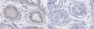 Anti-UBR5 Antibody, clone 2F14 ZooMAb&#174; Rabbit Monoclonal recombinant, expressed in HEK 293 cells