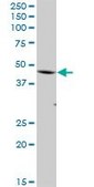 Anti-FBXO28 antibody produced in mouse purified immunoglobulin, buffered aqueous solution