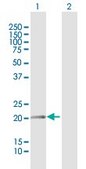 Anti-FN1 antibody produced in mouse purified immunoglobulin, buffered aqueous solution