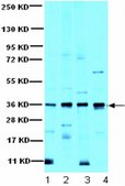 Anti-I&#954;B&#945; Antibody serum, from rabbit