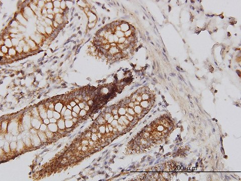 Monoclonal Anti-HIP1 antibody produced in mouse clone 1F12, purified immunoglobulin, buffered aqueous solution
