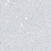 Anti-CD247 antibody produced in rabbit Prestige Antibodies&#174; Powered by Atlas Antibodies, affinity isolated antibody, buffered aqueous glycerol solution
