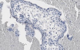 Anti-NF-kB p65 subunit Antibody, clone 1D8 ZooMAb&#174; Rabbit Monoclonal recombinant, expressed in HEK 293 cells