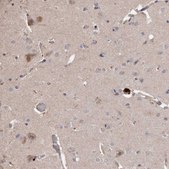 Anti-BRAT1 antibody produced in rabbit Prestige Antibodies&#174; Powered by Atlas Antibodies, affinity isolated antibody, buffered aqueous glycerol solution