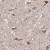 Anti-RAP1GAP antibody produced in rabbit Prestige Antibodies&#174; Powered by Atlas Antibodies, affinity isolated antibody, buffered aqueous glycerol solution