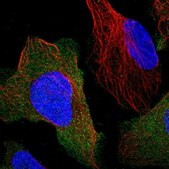 Anti-PPP3R1 antibody produced in rabbit Prestige Antibodies&#174; Powered by Atlas Antibodies, affinity isolated antibody, buffered aqueous glycerol solution