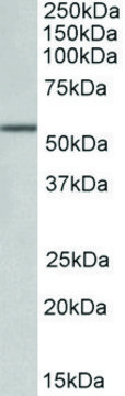 Anti-ALDH6A1 antibody produced in goat affinity isolated antibody, buffered aqueous solution